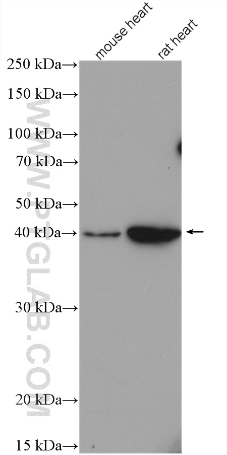 CYSLTR1 Polyclonal antibody