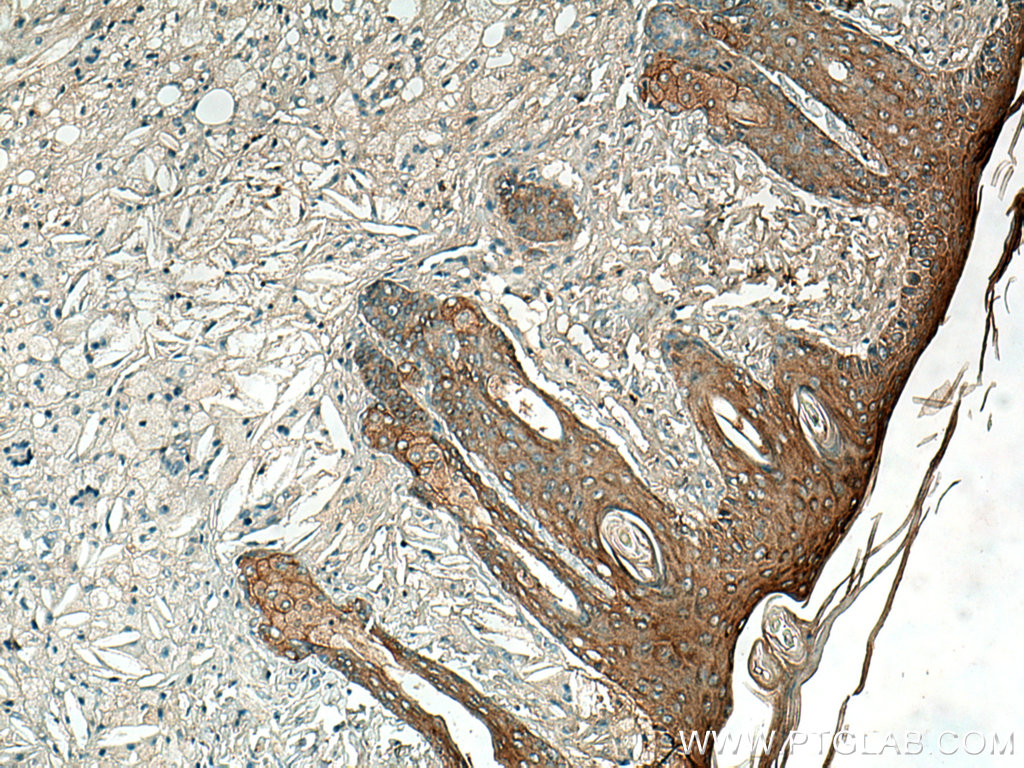 ABI1 Polyclonal antibody