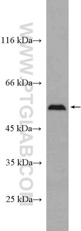 SELENBP1 Polyclonal antibody