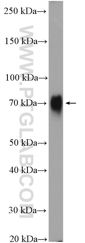 Poliovirus receptor Polyclonal antibody
