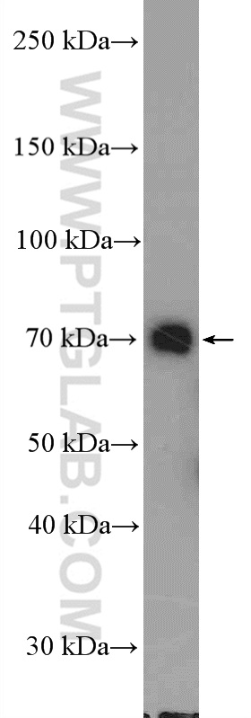 DDX41 Polyclonal antibody