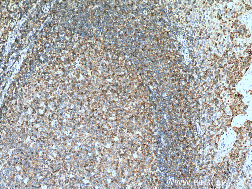 CD100 Polyclonal antibody