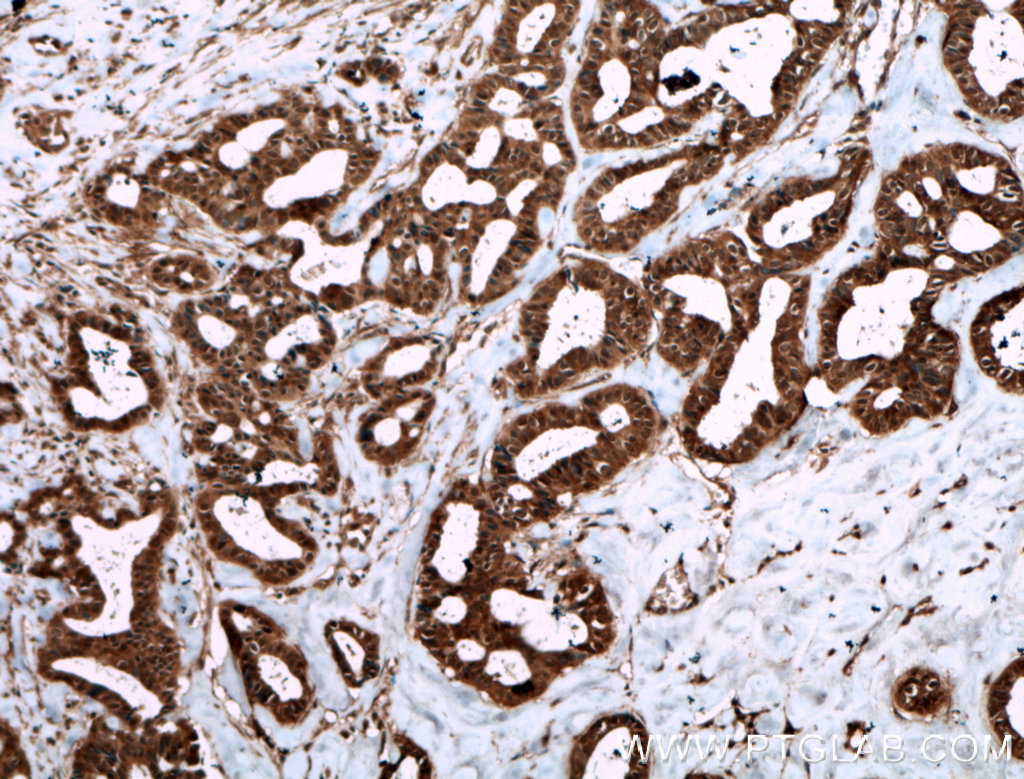 Livin Polyclonal antibody