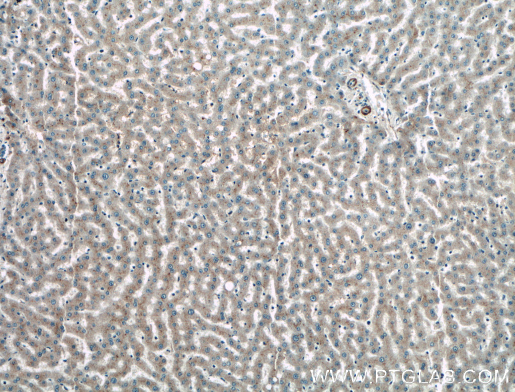 TAB1 Polyclonal antibody