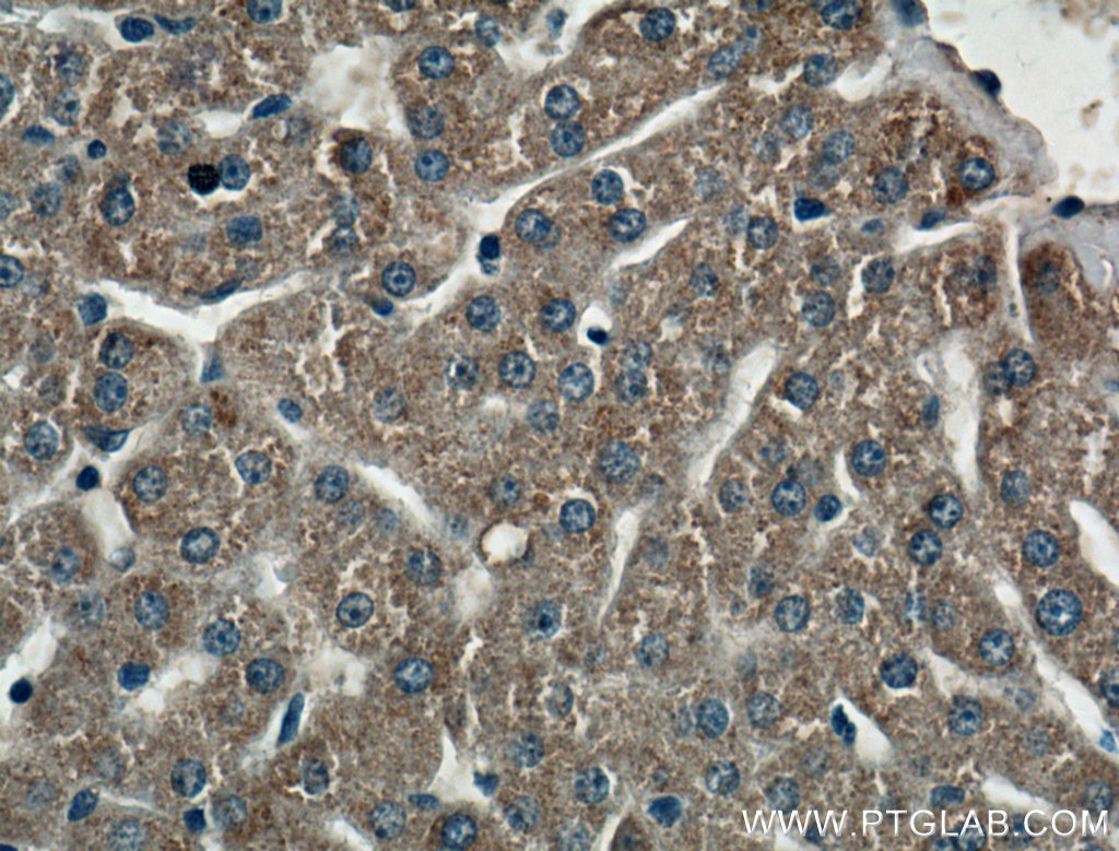 CIDEB Polyclonal antibody