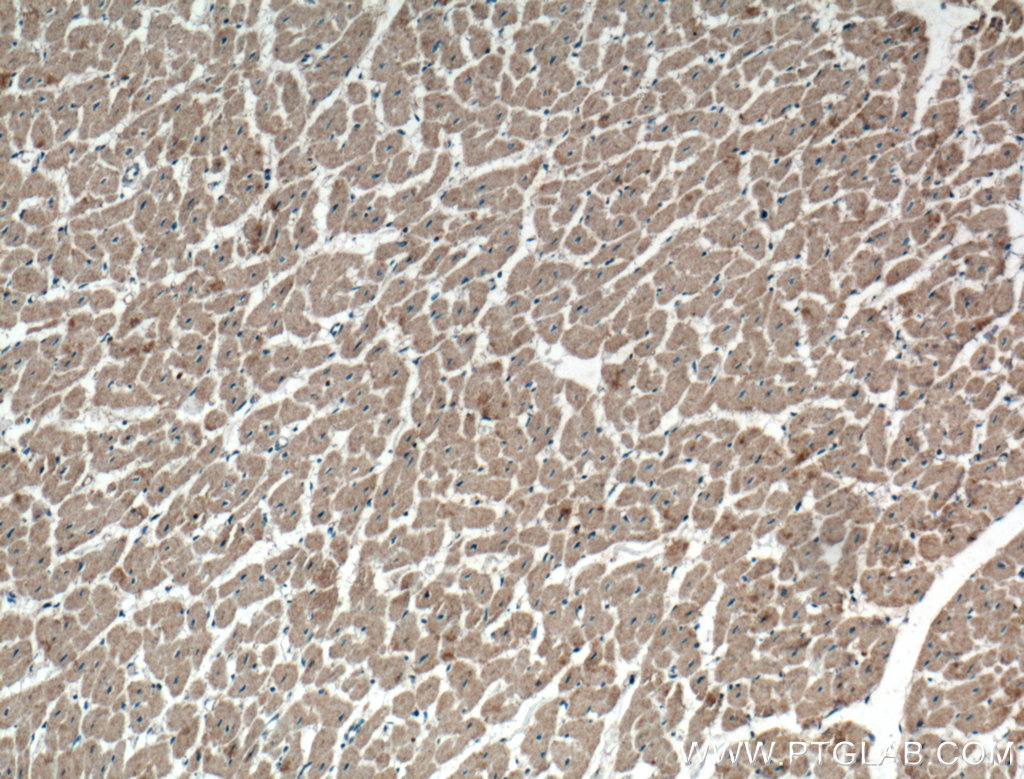 WDR8 Polyclonal antibody