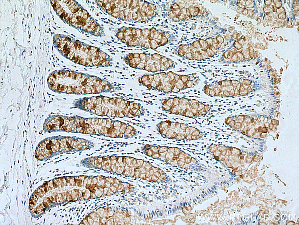 MUC2 Polyclonal antibody