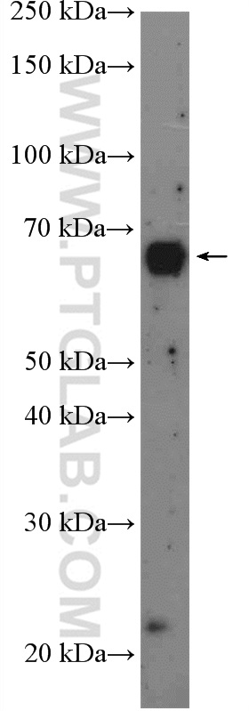 RCOR1 Polyclonal antibody