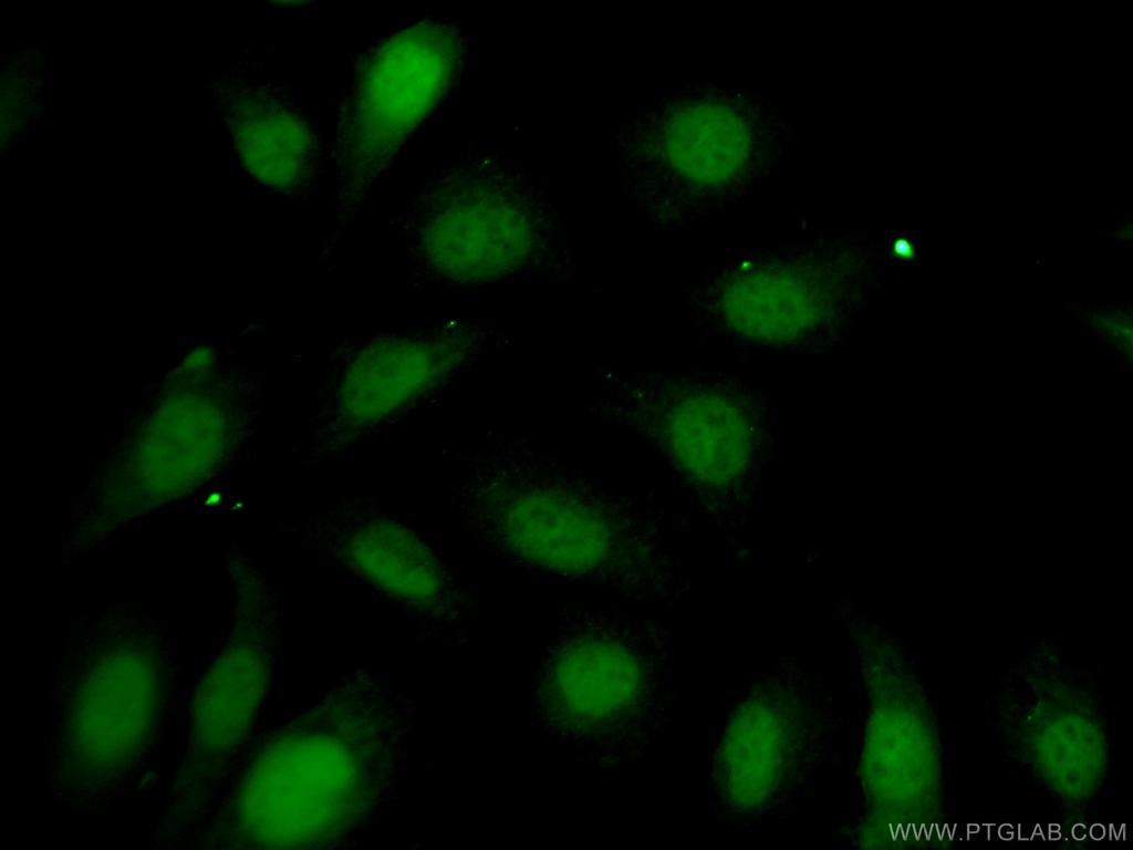 FTSJD2 Polyclonal antibody
