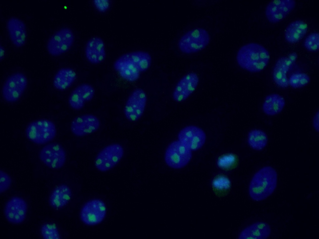 RRP1B Polyclonal antibody