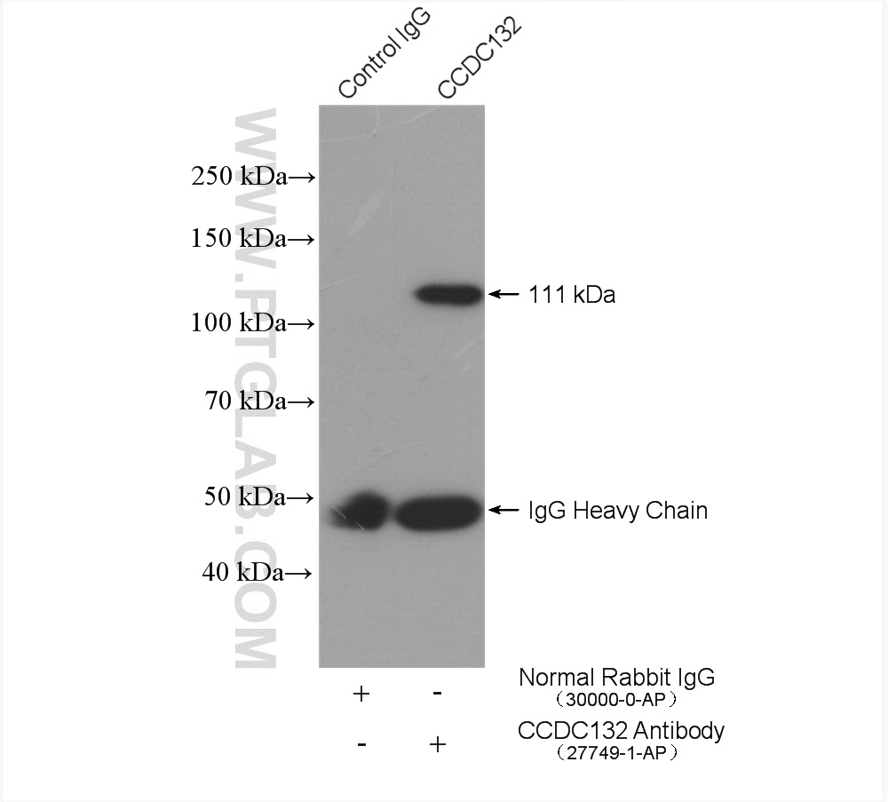 Syndetin/CCDC132 Polyclonal antibody