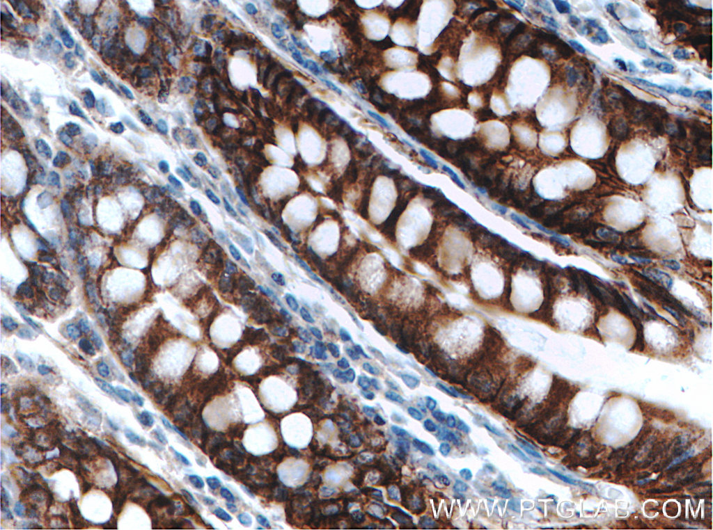 SLC26A2 Polyclonal antibody