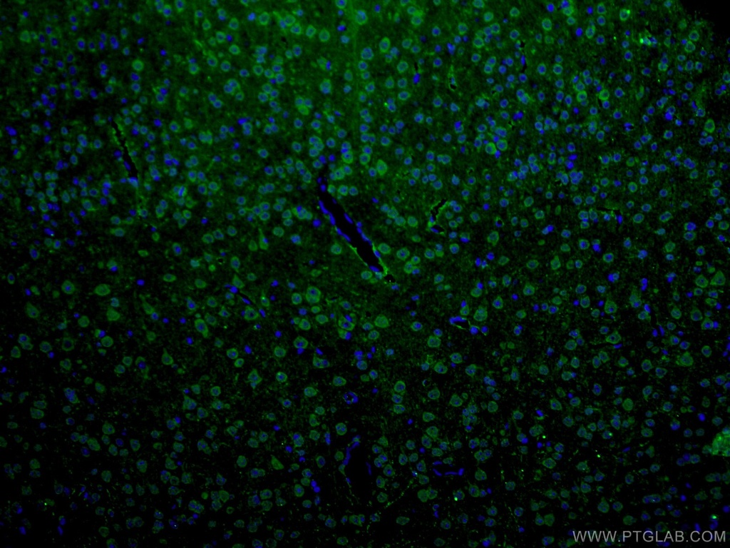 ANK3 Polyclonal antibody
