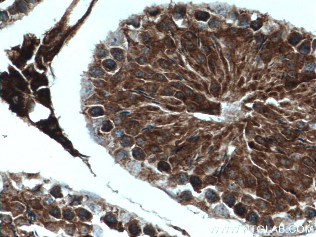 USP8 Polyclonal antibody