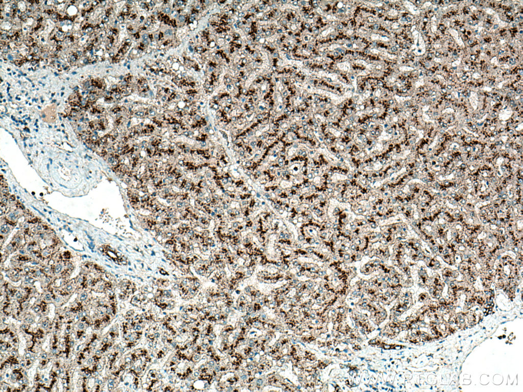 LAMP2 Polyclonal antibody