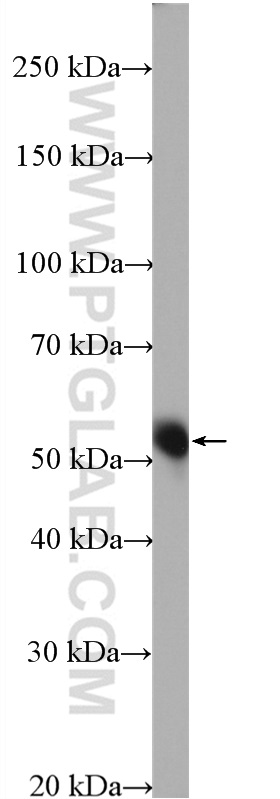 SIGIRR Polyclonal antibody