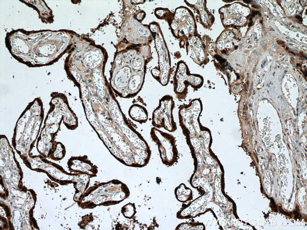 HSD17B1 Polyclonal antibody