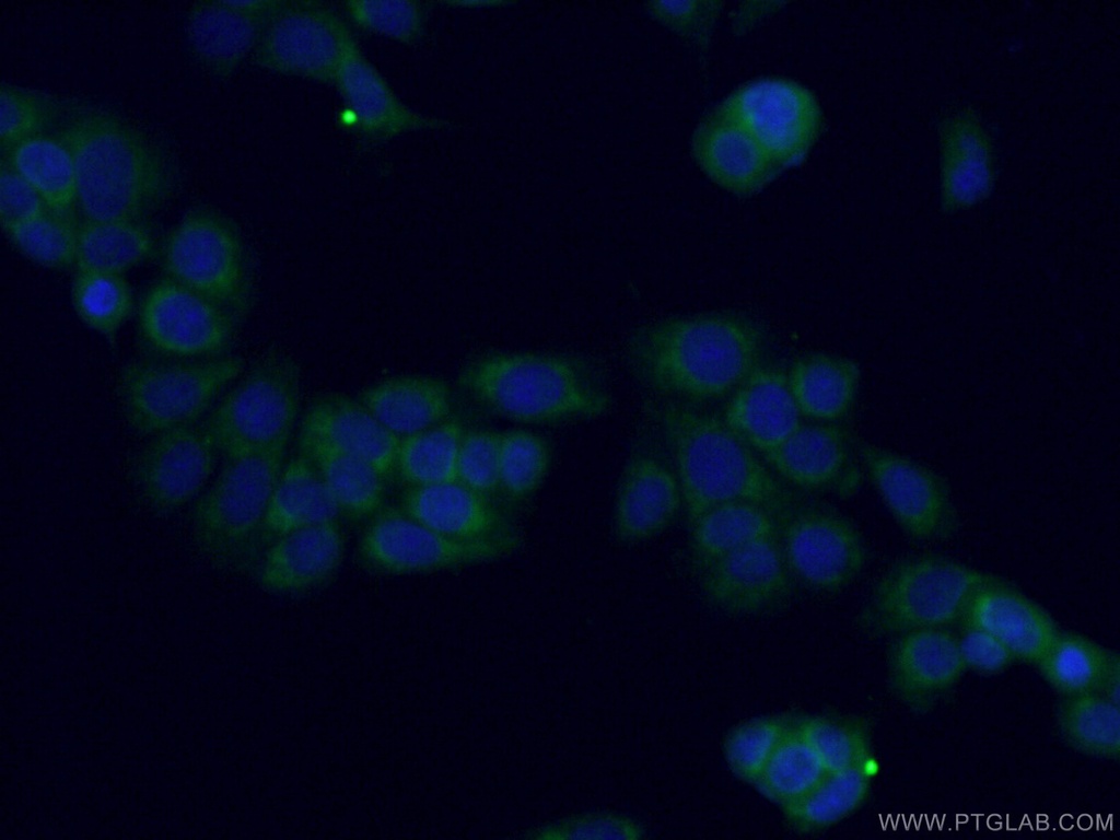 MTSS1L Polyclonal antibody