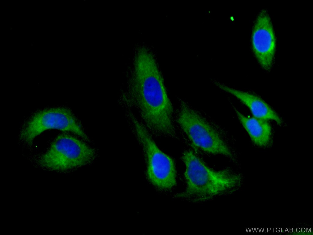 FMNL1 Polyclonal antibody