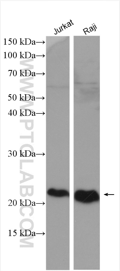 CD81 Polyclonal antibody