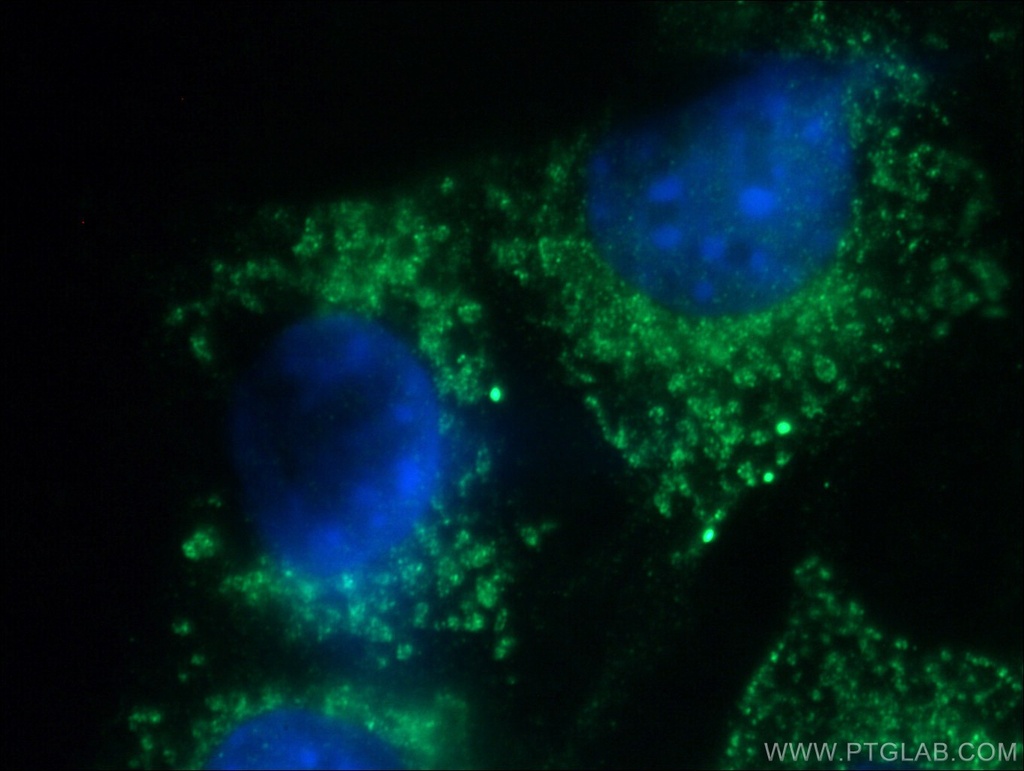 SLC25A46 Polyclonal antibody