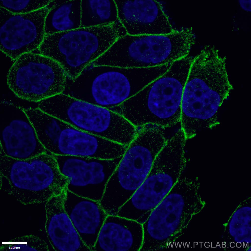 Gamma Catenin Polyclonal antibody