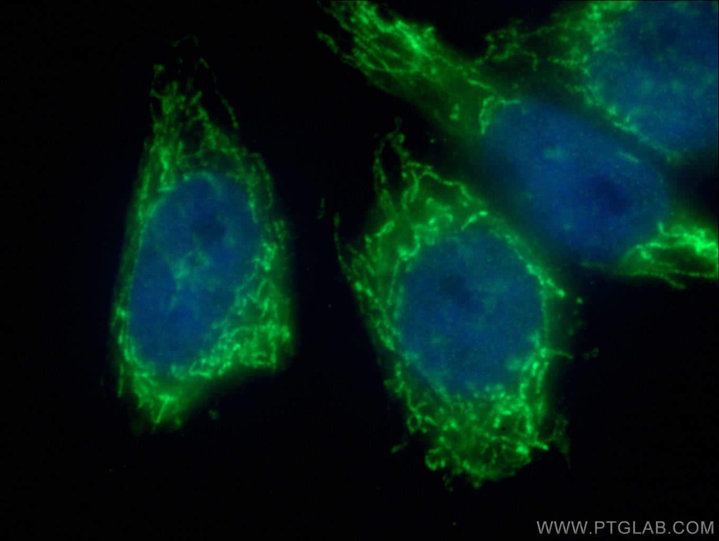 NDUFB4 Polyclonal antibody