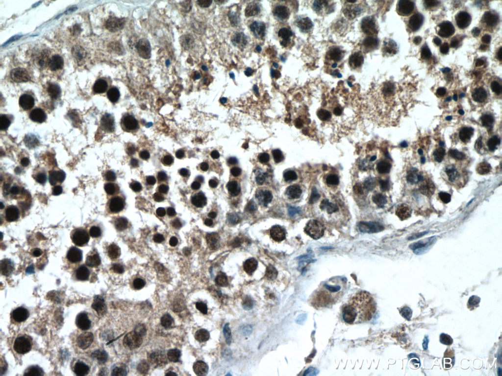PAK6 Polyclonal antibody
