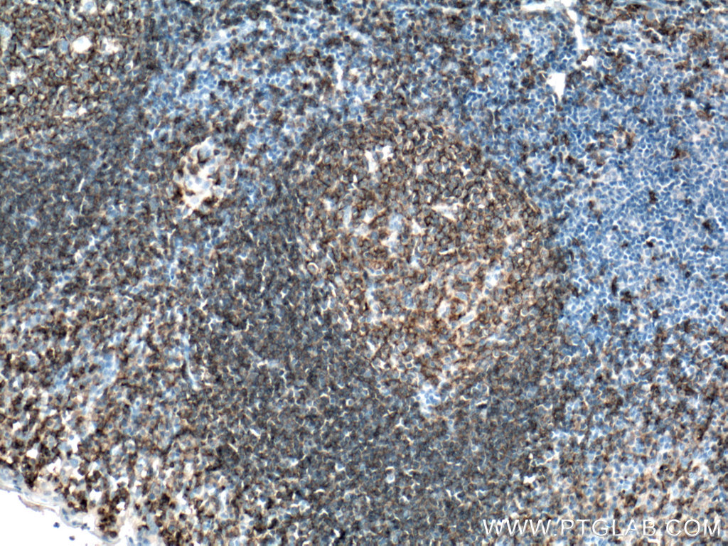 CD19 Polyclonal antibody