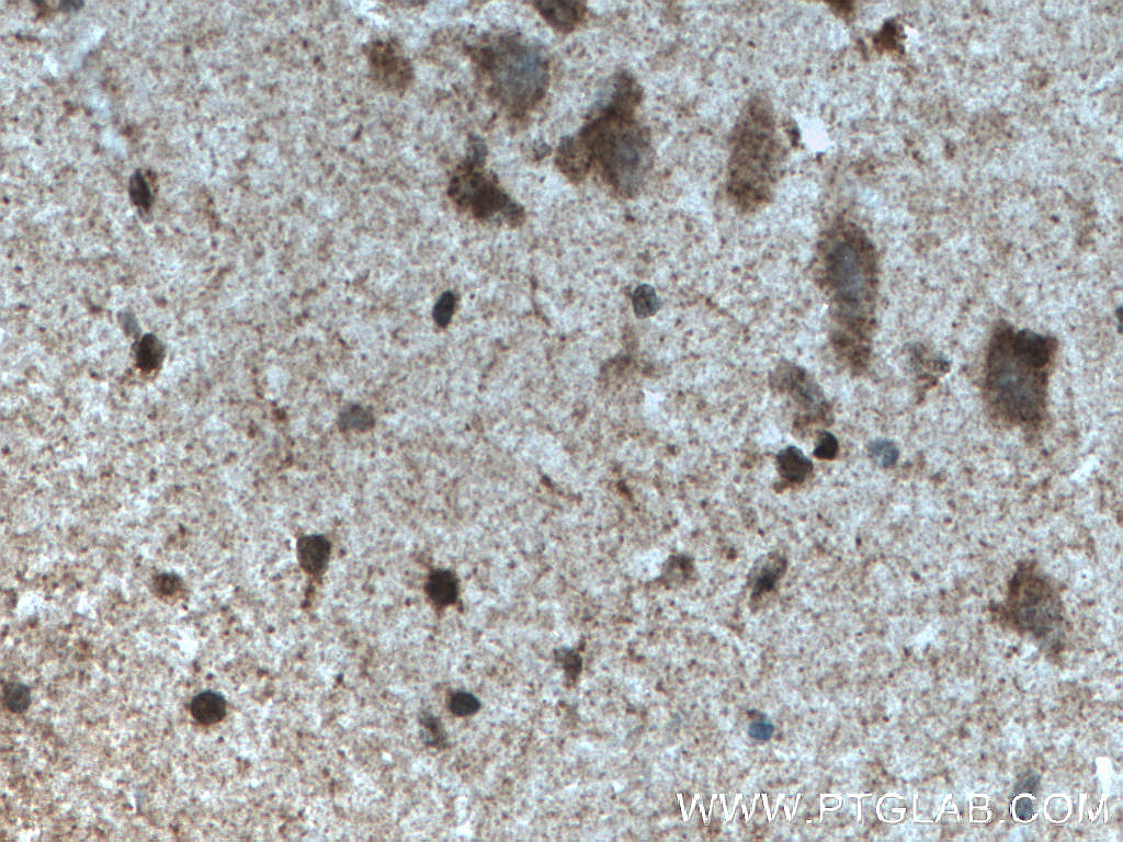 MYCBP2 Polyclonal antibody