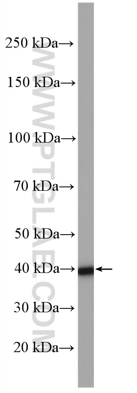 ALKBH1 Polyclonal antibody
