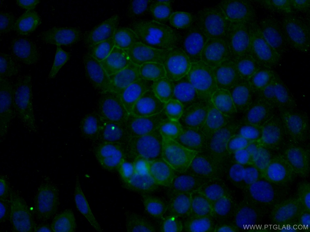 ANK3 Polyclonal antibody