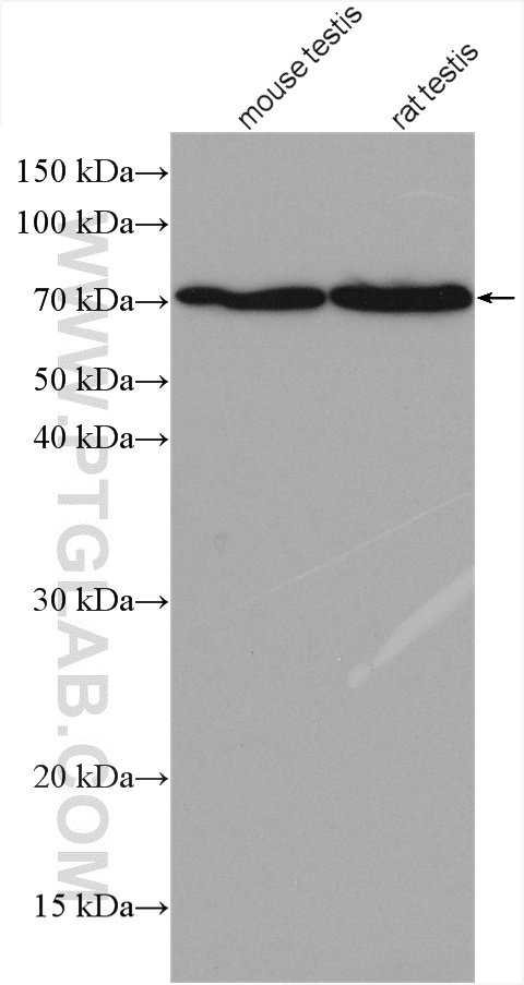 SPESP1 Polyclonal antibody