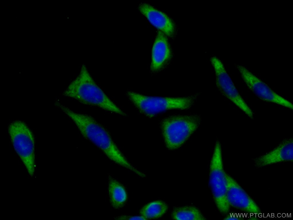 ATP1A3 (middle) Polyclonal antibody