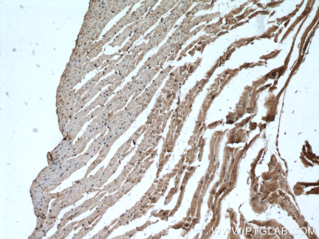 FADS2-Specific Polyclonal antibody