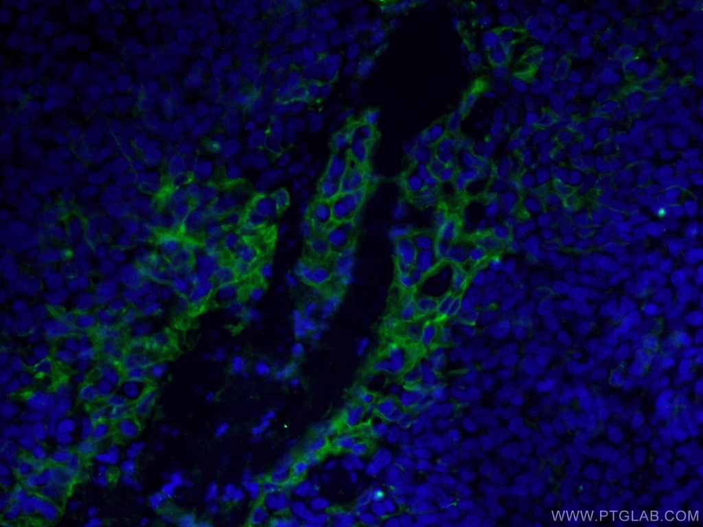 PD-L1/CD274 (C-terminal) Polyclonal antibody