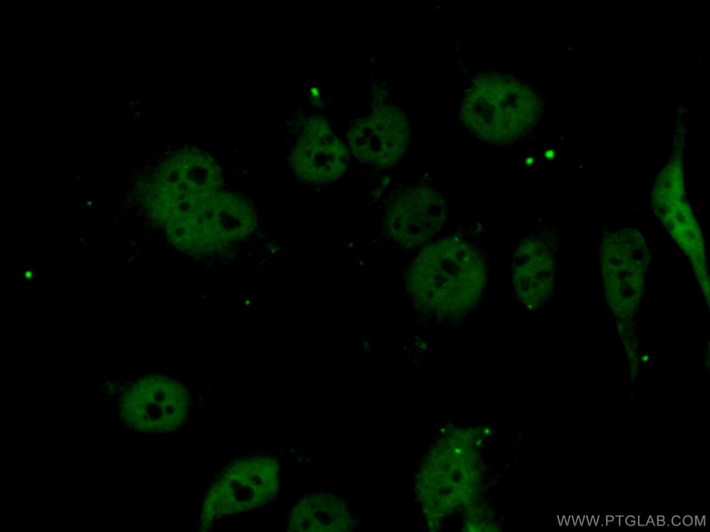 LIMD1 Polyclonal antibody