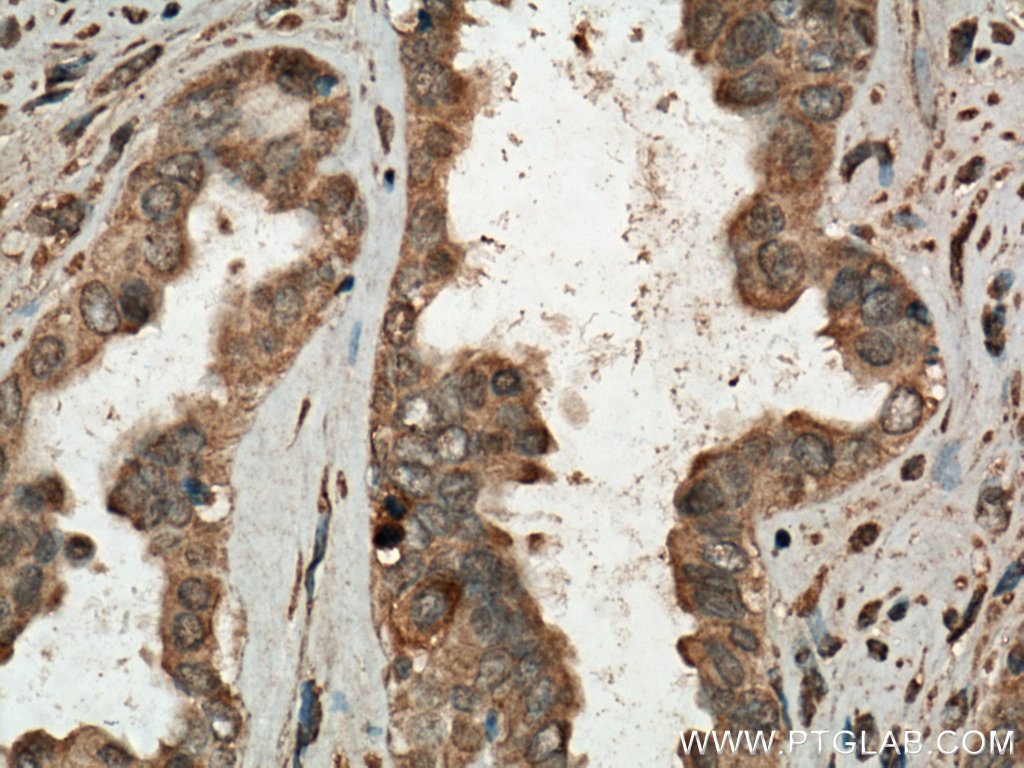 CDC25B Polyclonal antibody
