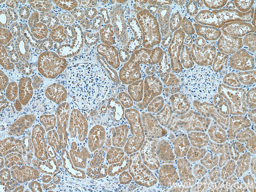 C3orf31 Polyclonal antibody