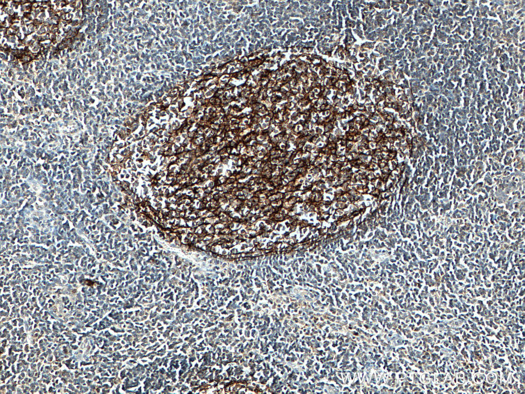 CD21 Polyclonal antibody