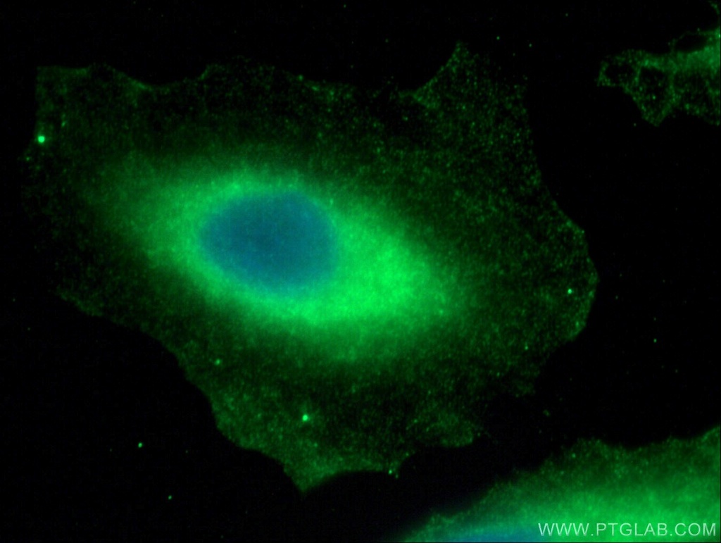 TTC12 Polyclonal antibody