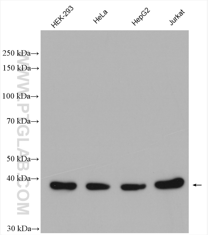 KTI12 Polyclonal antibody
