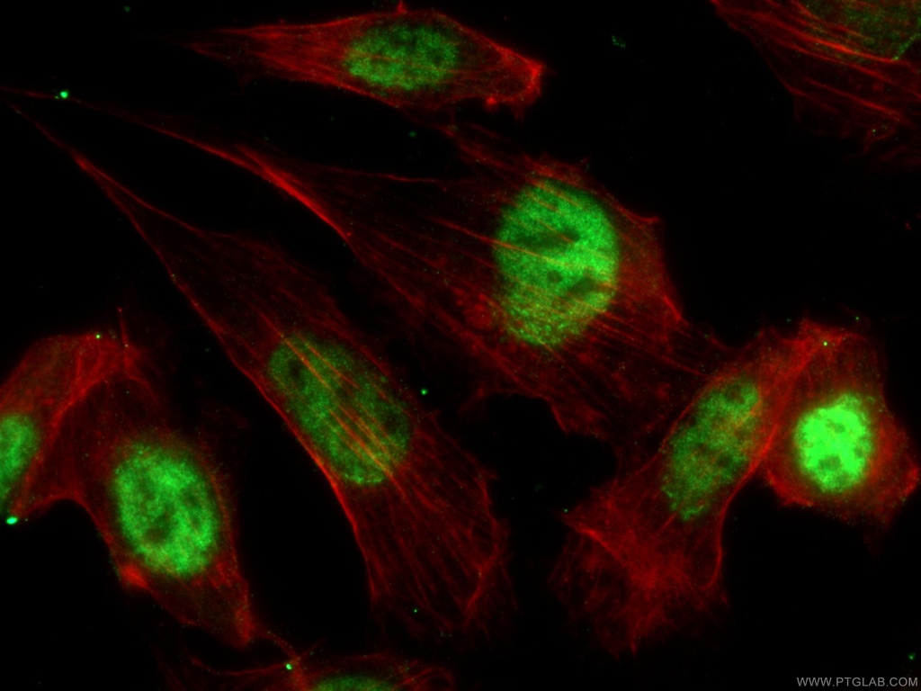 p21 Polyclonal antibody