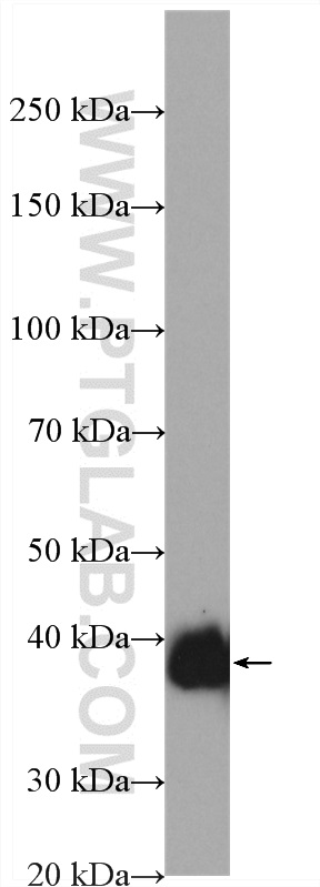 SFRP1 Polyclonal antibody