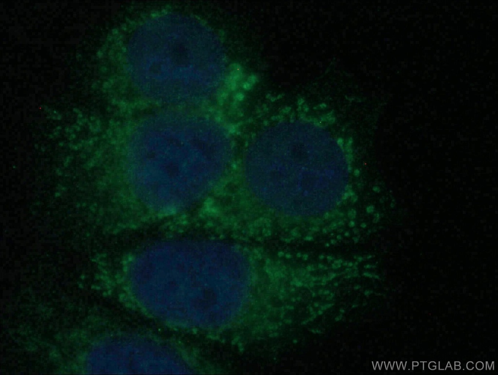 RAB17 Polyclonal antibody