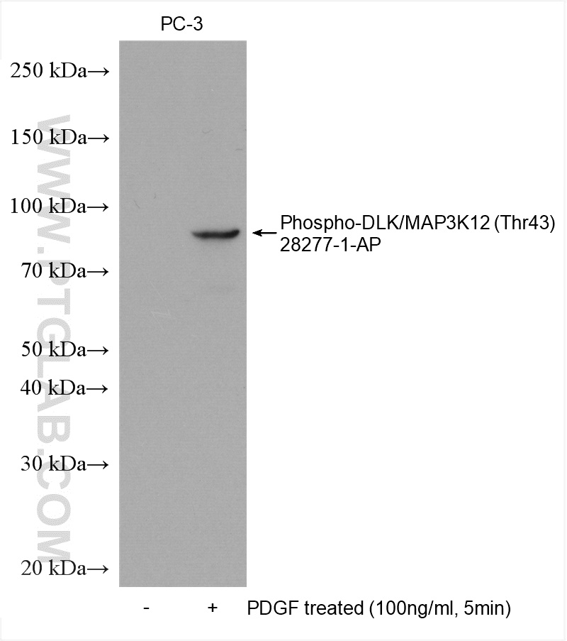 Phospho-DLK/MAP3K12 (Thr43) Polyclonal antibody