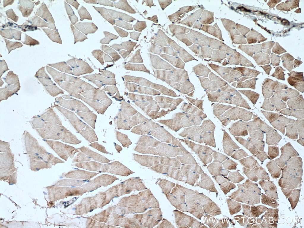 SCN4A Polyclonal antibody