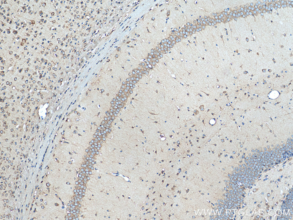 GIPR Polyclonal antibody