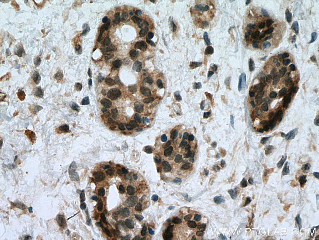 UBE2D1/2/3/4 Polyclonal antibody