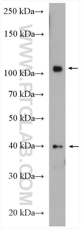 MTBP Polyclonal antibody